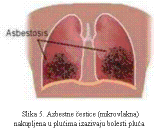 Azbestne cestice u plucima
