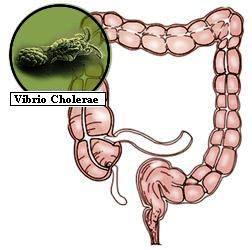 Vibrio cholerae