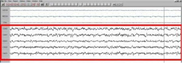 Ocitanja EEG-a